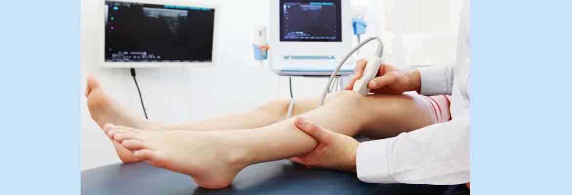 duplex ultrasound varicose veins